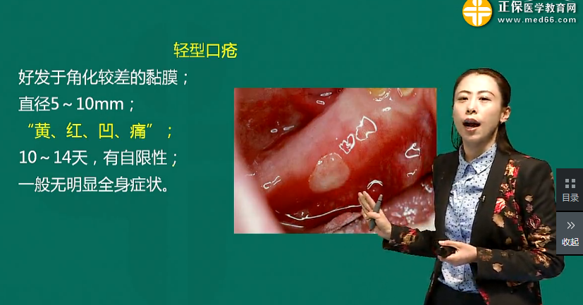 口腔内科学复发性口腔溃疡考点汇总