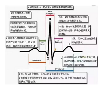 心电图