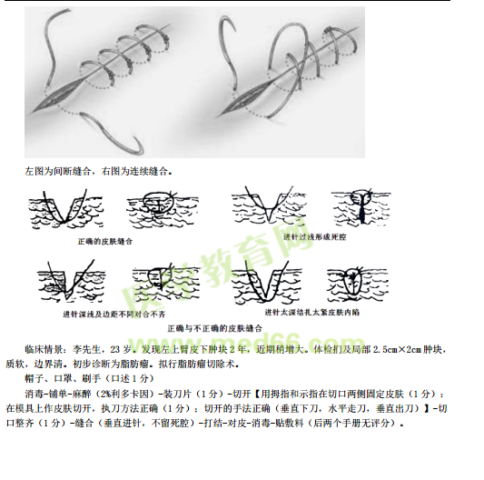 临床助理医师实践技能考点-外科手术基本操作（附图片）