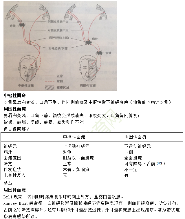 中枢性面瘫与周围性面瘫